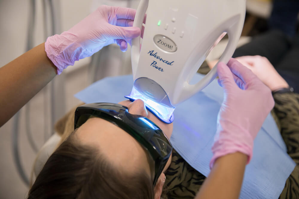 LED Light Whitening