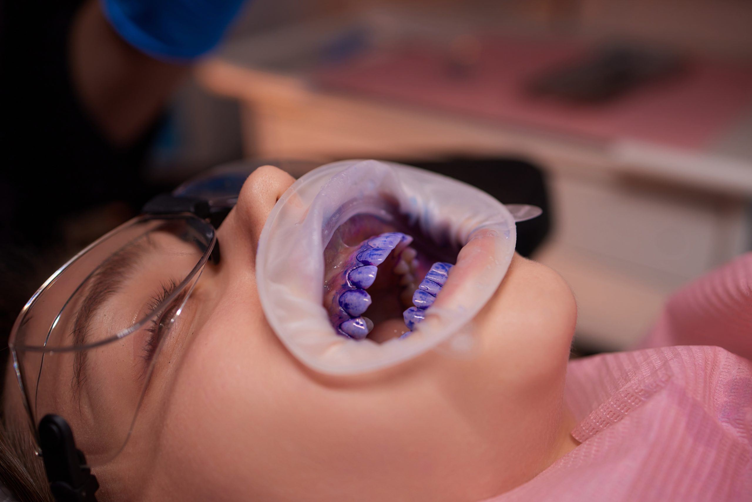 GBT treatment